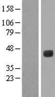 IL6R Human Over-expression Lysates NM_181359
