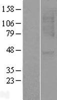 CXCR1 Human Over-expression Lysates NM_000634