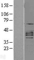 CXCR2 Human Over-expression Lysates NM_001557