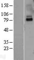 ls003587 il10ra human over expression lysates nm 001558 wb testing 1
