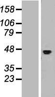 IL11RA Human Over-expression Lysates NM_004512