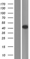 IL11RA Human Over-expression Lysates NM_147162