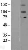 IL12RB2 Human Over-expression Lysates NM_001559