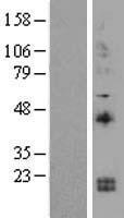 IL15 Human Over-expression Lysates NM_172174