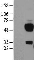 IL15RA Human Over-expression Lysates NM_002189