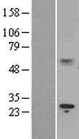 IL15RA Human Over-expression Lysates NM_172200