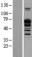 IL16 Human Over-expression Lysates NM_004513