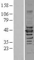 ILF2 Human Over-expression Lysates NM_004515