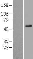Integrin Linked Kinase (ILK) Human Over-expression Lysates NM_001014794