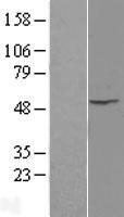 Integrin Linked Kinase (ILK) Human Over-expression Lysates NM_001014795