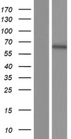 IMPDH1 Human Over-expression Lysates NM_001102605