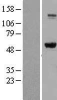 ls003615 impdh2 human over expression lysates nm 000884 wb testing 1