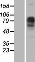 IMPG1 Human Over-expression Lysates NM_001563