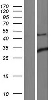 ING1 Human Over-expression Lysates NM_005537