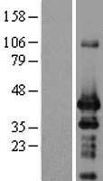 ING1 Human Over-expression Lysates NM_198218