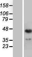 ING1 Human Over-expression Lysates NM_198219
