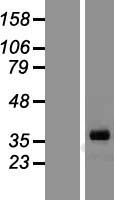 Inhibin alpha (INHA) Human Over-expression Lysates NM_002191