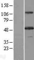 Inhibin beta A (INHBA) Human Over-expression Lysates NM_002192
