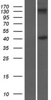 Inhibin beta B (INHBB) Human Over-expression Lysates NM_002193