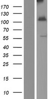 ls003631 inpp4a human over expression lysates nm 001566 wb testing 2