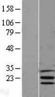 INSIG1 Human Over-expression Lysates NM_005542