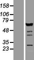IRF5 Human Over-expression Lysates NM_001098628