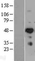 IRF6 Human Over-expression Lysates NM_006147