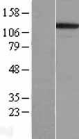 Integrin alpha 3 (ITGA3) Human Over-expression Lysates NM_002204