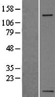 Integrin alpha 5 (ITGA5) Human Over-expression Lysates NM_002205