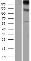 Integrin alpha E (ITGAE) Human Over-expression Lysates NM_002208