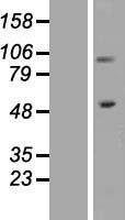 Integrin beta 1 (ITGB1) Human Over-expression Lysates NM_033668