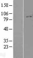 Integrin beta 1 (ITGB1) Human Over-expression Lysates NM_133376