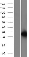 Integrin beta 4 binding protein (EIF6) Human Over-expression Lysates NM_181468