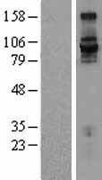 Integrin beta 7 (ITGB7) Human Over-expression Lysates NM_000889