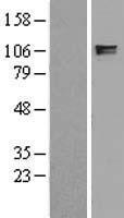 ITIH2 Human Over-expression Lysates NM_002216