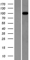 ITIH3 Human Over-expression Lysates NM_002217
