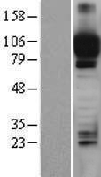 ITIH4 Human Over-expression Lysates NM_002218