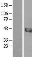IVD Human Over-expression Lysates NM_002225
