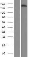 JARID2 Human Over-expression Lysates NM_004973