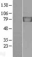 gamma Catenin (JUP) Human Over-expression Lysates NM_002230