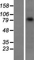 gamma Catenin (JUP) Human Over-expression Lysates NM_021991