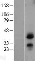 CD82 Human Over-expression Lysates NM_002231