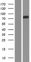 Lysyl tRNA synthetase (KARS) Human Over-expression Lysates NM_001130089