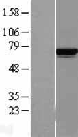 Lysyl tRNA synthetase (KARS) Human Over-expression Lysates NM_005548
