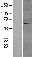 KCND1 Human Over-expression Lysates NM_004979