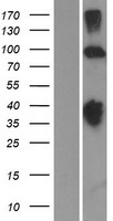 KCNH2 Human Over-expression Lysates NM_172056