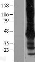 GIRK2 (KCNJ6) Human Over-expression Lysates NM_002240