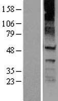 KCNJ8 Human Over-expression Lysates NM_004982