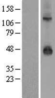 ls003765 kcnj9 human over expression lysates nm 004983 wb testing 1