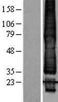 KCNK1 Human Over-expression Lysates NM_002245